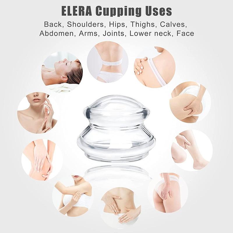 Advanced Silicone Cupping Set (4PCS)